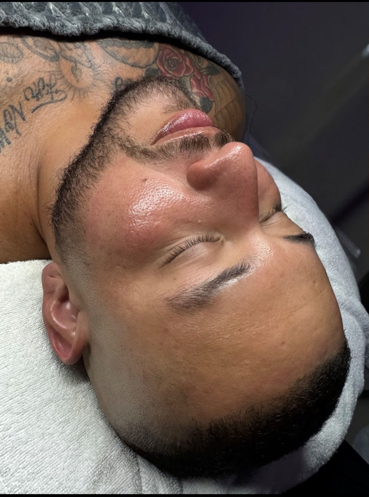 Revitalize Your Skin Naturally